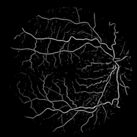 Blutgefäßerkennung