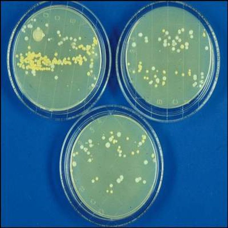 Mikrobiologische Untersuchung